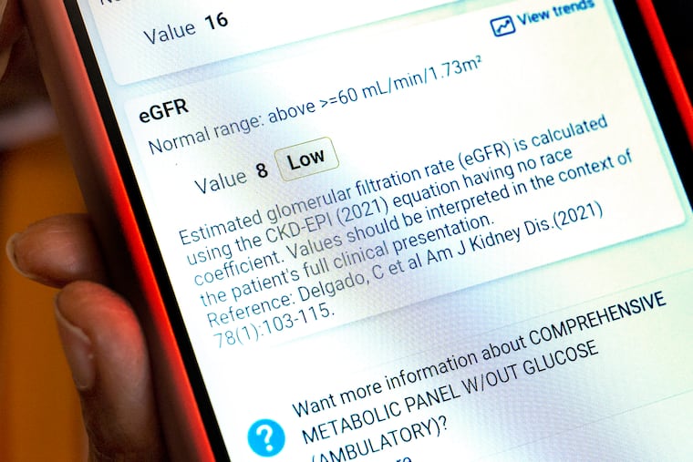 A patient waiting for a kidney transplant shows a notation from her medical charts.