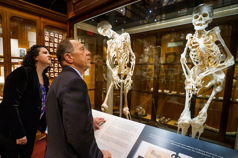 Anna Dhody, Mutter Museum Curator, left, and Dr. Fred Kaplan, the world's preeminent FOP researcher, second from left, look at Carol Orzel's skeleton, far right, at the Mutter museum, in Philadelphia in 2019. To the far left is the skeleton of Harry Eastlake, who died in 1973, also diagnosd with fibrodysplasia ossificans progressiva.